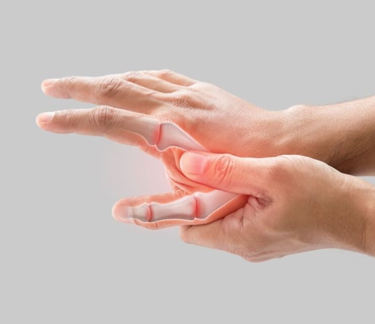 A man has a sore palm because of inflammation of the finger bone.
