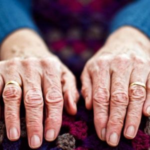 natural remedies for arthritis