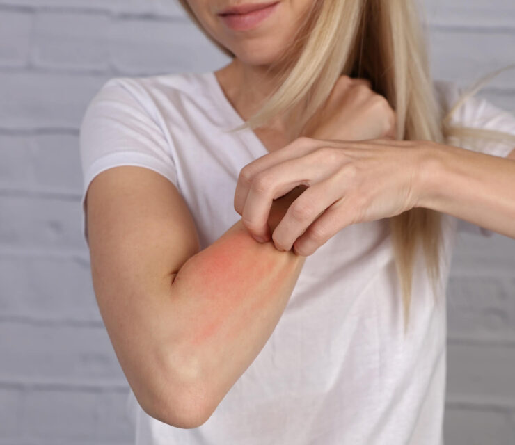 Woman Scratching an itch on white background . Sensitive Skin, dry winter skin
