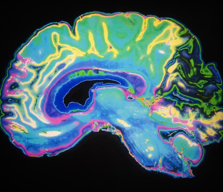 Artificially Colored MRI Scan Of Human Brain
