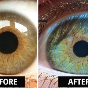eye color change carly fraser raw vegan