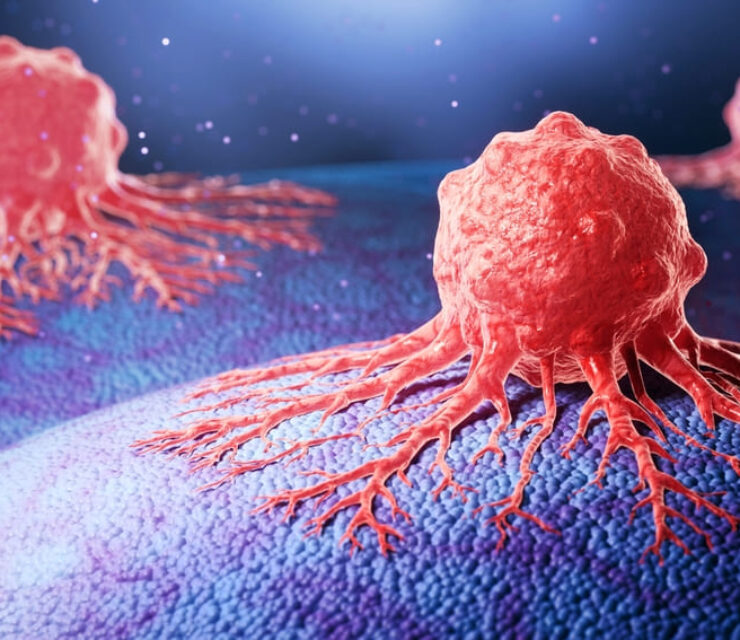 Cancer cells on human tissue. 3D illustration.