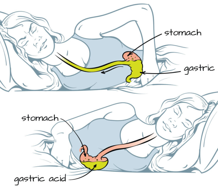 Vector illustration of health benefits of sleeping on your left side, infographic.