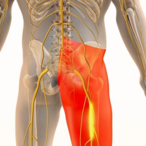 Painful Sciatic Nerve Sensation in Lower Body