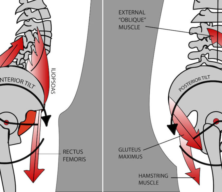 graphic anatomical representation of anterior pelvic tilt