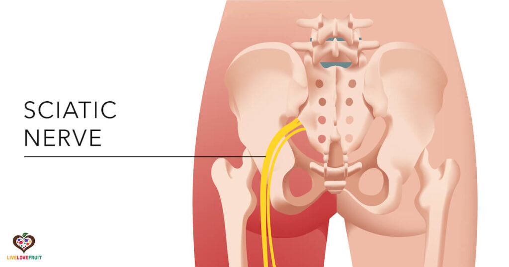 visual diagram of sciatic nerve pain