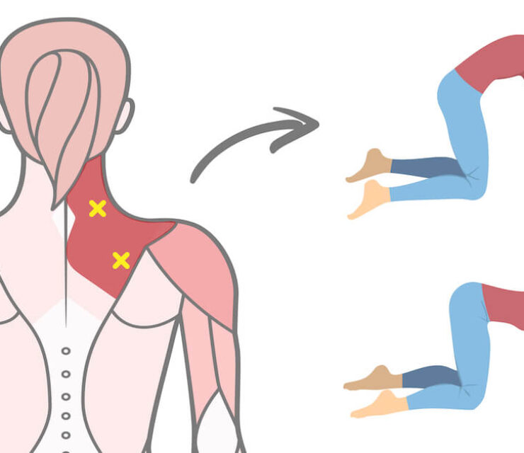 illustration of trigger points in shoulder next to cat and cow stretch