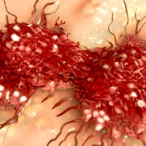 Dividing cancer cell