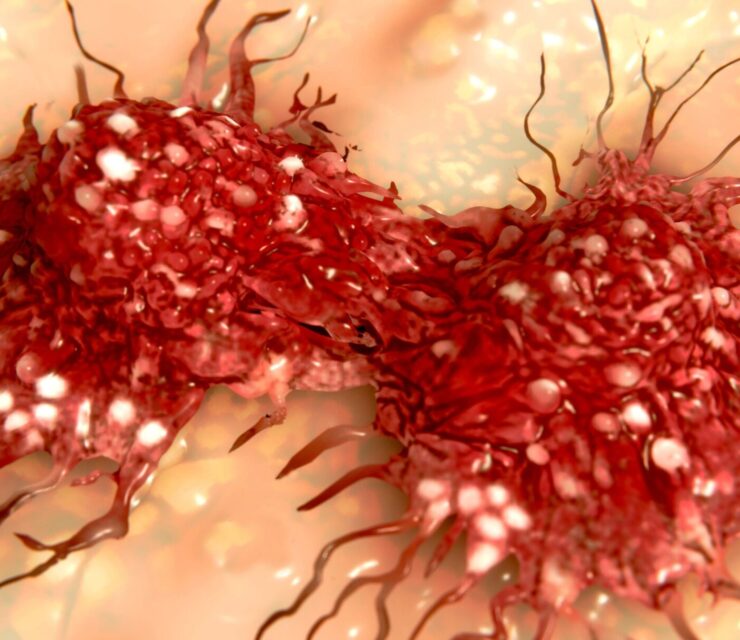 Dividing cancer cell