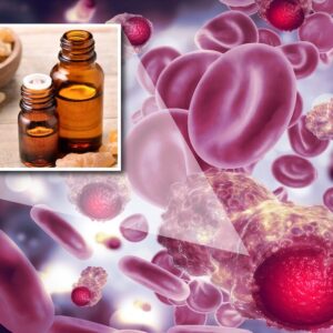 How to Use Frankincense Oil for Cancer
