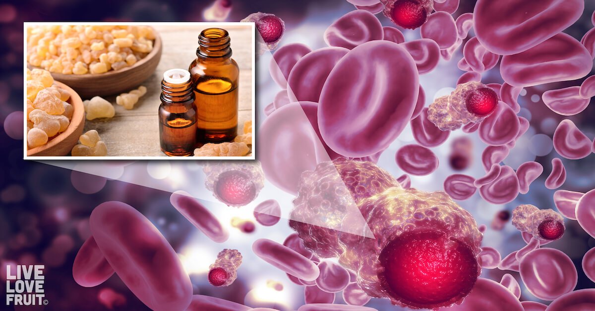 How to Use Frankincense Oil for Cancer and Arthritic Pain